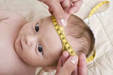 Sindromul hidrocefalie la sugari - Simptome si tratament