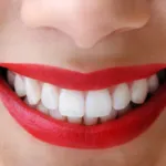 Cum de a elimina rapid acnee pe frunte câteva sfaturi de la un dermatolog pentru tine