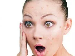 Cum de a elimina rapid un comedon inflamate, acnee tratament la domiciliu (facială) Cum de a elimina rapid un comedon inflamate, acnee tratament la domiciliu