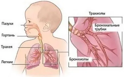 Cât de repede vindeca bronșită într-un copil