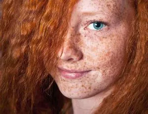 Cum sa scapi de pistrui pe fata ei acasa (cum sa scapi de pistrui pe fata ei cum să scapi de pistrui pe fata ei acasă pentru a scăpa de pistrui pe fața lui toate la domiciliu) Cum sa scapi de pistrui pe fața lui de la domiciliu