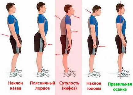 Cum de a stabili sutolost la exerciții de acasă, corset, masaj, yoga (condiții) Cum de a stabili sutolost la exerciții de acasă, corset, masaj, yoga