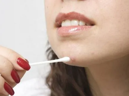 Cum de a scuti de inflamație de acnee, decât să-l elimine pe fața lui rapid (acnee) Cum de a scuti de inflamație de acnee, decât repede eliminați-l pe față
