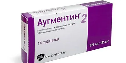 Tratamentul parodontitei la popular acasă și metodele tradiționale la adulți (tratament) Tratamentul parodontitei la popular acasă și metodele tradiționale la adulți