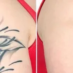 Cum sa faci un tatuaj acasa sau cu laser