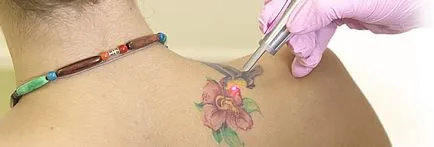 Cum sa faci un tatuaj acasa sau cu laser