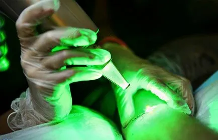 Cum sa faci un tatuaj acasa sau cu laser
