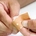 Cum de a ascunde o cicatrice
