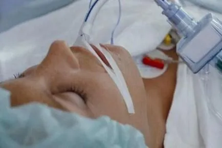 accident vascular cerebral Coma continua ca prognoza, efectele