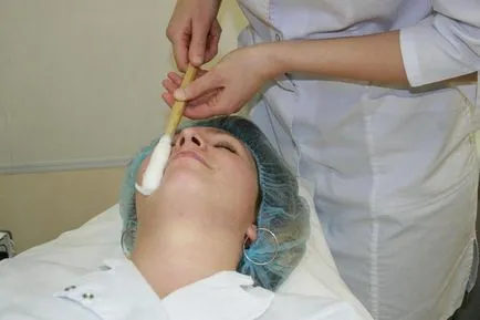 Cryospray