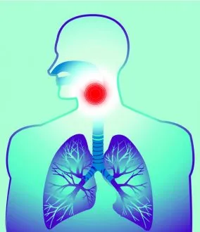 Laringită - adică, cauzele, tipurile, tratamentul și prevenirea (specii) Laringită - adică, cauzele, tipurile, tratamentul și prevenirea