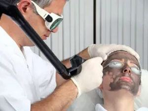 Peelingul cu laser și resurfacing feței - ceea ce este (piele cu laser resurfacing) Peelingul cu laser și resurfacing feței - ceea ce este