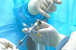 Tratamentul de hernie coloanei vertebrale lombare sacral conservatoare și operativă (tratament) Tratamentul de hernie spinal lombosacrală operative conservatoare și