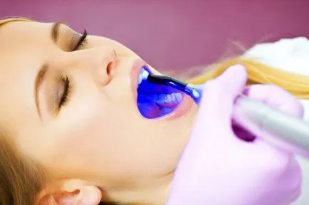 tratamentul cu laser de avantaje și dezavantaje cariilor dentare (carii) tratamentul cu laser de avantaje și dezavantaje cariilor dentare