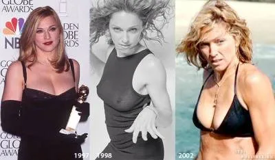 Chirurgie plastica Madonna - material plastic - Publisher - corp din plastic