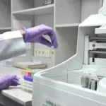Fibroamele si simptome si tratament Endometrioza