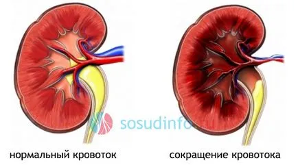 tulburări microcirculației, îmbunătățite (medicamente) (ameliorare) tulburări de microcirculație, imbunatatite (droguri)