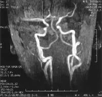 Expert RMN, angiografie MR în studiul arterelor cerebrale (cerebrală) Expert RMN, angiografie MR în studiul arterelor cerebrale