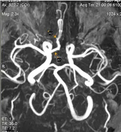 Expert RMN, angiografie MR în studiul arterelor cerebrale (cerebrală) Expert RMN, angiografie MR în studiul arterelor cerebrale
