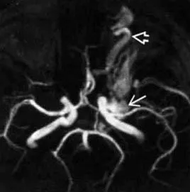 Expert RMN, angiografie MR în studiul arterelor cerebrale (cerebrală) Expert RMN, angiografie MR în studiul arterelor cerebrale