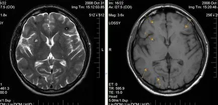 Expert RMN, angiografie MR în studiul arterelor cerebrale (studiu) Expert RMN, angiografie MR în studiul arterelor cerebrale