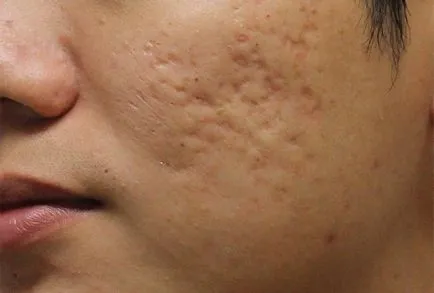 piele facială aspră cauze, foto, cum să se ocupe cu acest lucru, recomandările video ale medicilor
