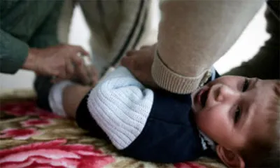 Circumcizia pentru musulmani de ce și ce fac ritualul în Islam pentru ceea ce este, și precum și (pentru un motiv oarecare circumcis musulmani) Circumcizia pentru musulmani De ce și ce fac ritualul în Islam pentru ceea ce este, și precum și