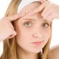 Masca cu tratamente faciale de casă peroxid de piele inflamate (masca de peroxid de hidrogen din piele reteta) Masca cu peroxid facial piele tratamente de casă inflamat