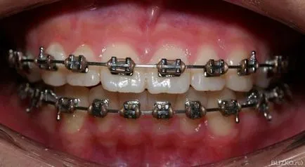 Opinii Smile Dental (Krasnodar) (examen preventiv gratuit) Opinii Smile Dental (Krasnodar)