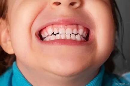 Opinii Smile Dental (Krasnodar) (examen preventiv gratuit) Opinii Smile Dental (Krasnodar)