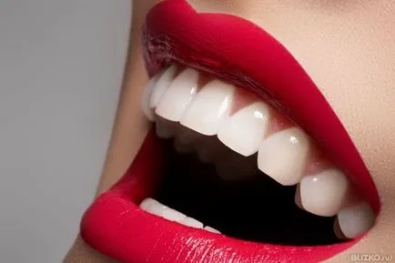 Opinii Smile Dental (Krasnodar) (zâmbet) Opinii Smile Dental (Krasnodar)