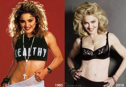Chirurgie plastica Madonna