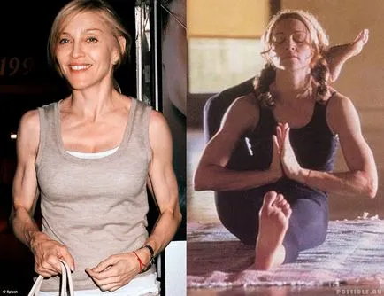 Chirurgie plastica Madonna