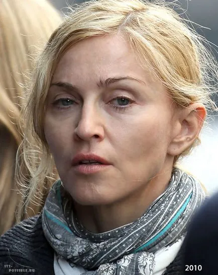 Chirurgie plastica Madonna