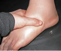 De ce picioare umflate de sex masculin - identificarea și tratarea problemelor (picioarelor) De ce picioare umflate de sex masculin - identificarea și tratarea problemelor
