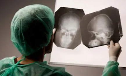 După ce la lovit cu capul de durerea de cap poate fi și ce să facă, sănătatea scalpului