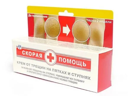 Unguent pentru fisuri pe tocuri de picior decât frotiu pentru vindecare rapidă
