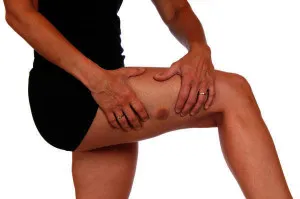 vergeturi pe picioare de adolescenți, cauze și tratament la domiciliu (stretching) vergeturi pe picioare de adolescenți, cauze si tratament la domiciliu