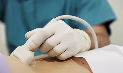 dimensiuni de rinichi intr-o rata de ultrasunete la adulți Transcrierea