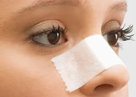 Rhinoseptoplasty - forma de corecție și funcția de nas pe