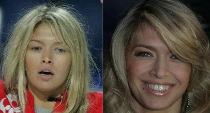 Stele din Romania fara machiaj, machiaj și privire de ansamblu Photoshop și fotografii (machiaj) Stele din România, fără make-up, make-up și privire de ansamblu Photoshop și fotografii