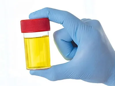 Urina - compoziție, indicații și contraindicații pentru utilizare