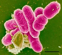 Shigella (shigella)