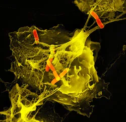 Shigella (shigella)