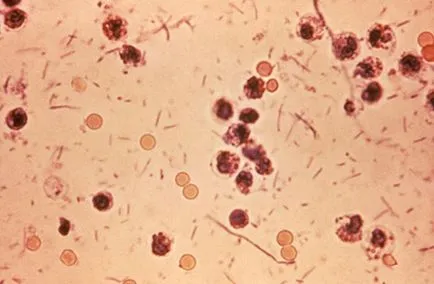 Shigella (shigella)
