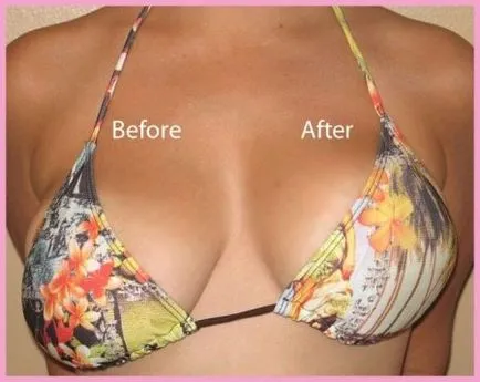 sutien silicon (87 poze) invizibil sutien cu silicon spate, reale și invizibile (foto) sutien silicon (87 poze) invizibil sutien cu silicon spate, reale și invizibile