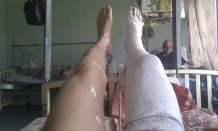 Cum să meargă în ghips, cu un picior rupt