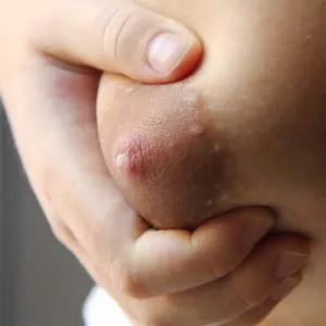 La ce perioadă de sarcină există un colostru în primul rând, de culoare și aspect motive (colostru în timpul sarcinii) La ce perioadă de sarcină există un prim colostru, culoarea și cauzele