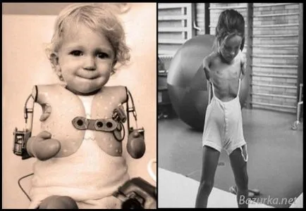 fapte Thalidomide - portalul legendar, fapte și umor (Chemie) fapte Thalidomide - portalul legendar, fapte și umor