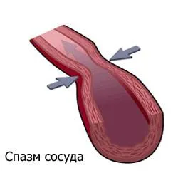 angina vasospastică (aceeași variantă, Prinzmetal spontană) (vasospastică) angina vasospastică (aceeași variantă, Prinzmetal spontană)